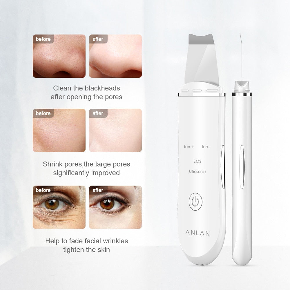 Ultrasonic Skin ScrubberUltrasonic Skin Scrubber is an innovative beauty product with a 3 in 1 function that removes oil, dirt, clogged pores, and dead cells, and fills your favorite skinca